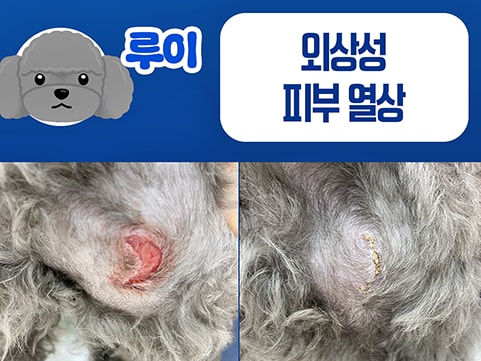 갑작스러운 피부 열상, 상처 치료와 회복 관리