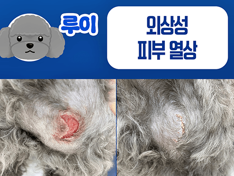 갑작스러운 피부 열상, 상처 치료와 회복 관리